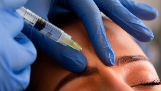 Se conoció cuál es el efecto secundario del botox que nadie se anima a decir