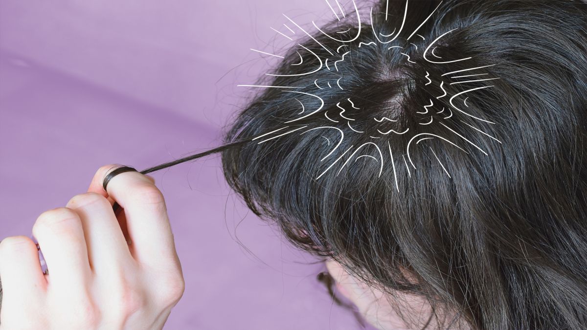 El scalp popping puede desgarrar fácilmente la parte interna del cuero cabelludo y ocasionar hemorragias o posibles infecciones.