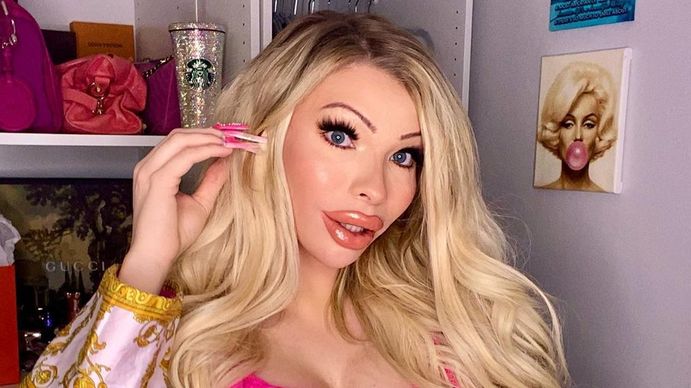 Joven de 23 años gastó 50 mil euros en cirugías para ser Marilyn Monroe: No pienso frenar