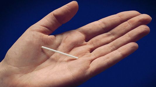 Día Mundial de la Anticoncepción: cómo funciona el implante subdérmico para evitar embarazos y qué efectividad tiene