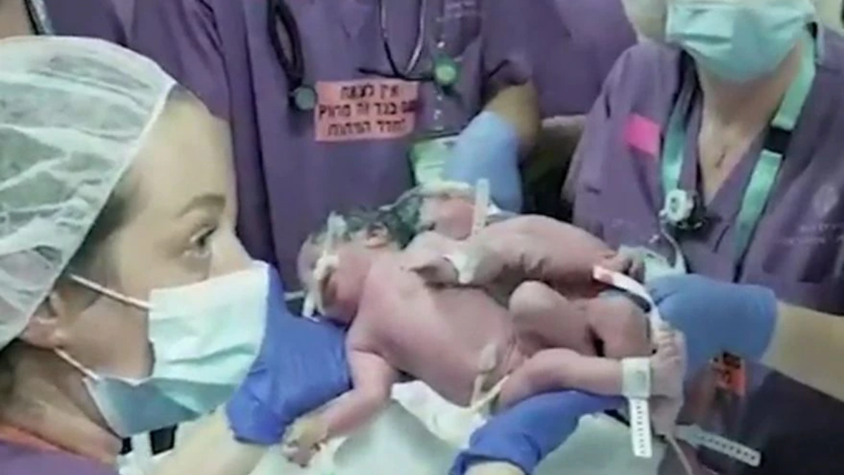 Para la operación se introdujeron expansores de piel y tejido bajo el cuero cabelludo de las niñas, con el objetivo de que se estirara la piel al crecer, para que luego los cirujanos pudieran cerrar el cuero cabelludo tras la separación.