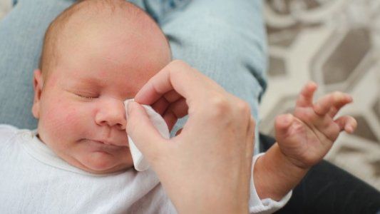 Conjuntivitis en bebés: lo que hay que saber