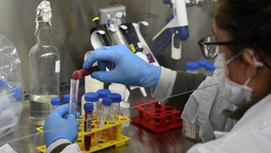Prueban un cóctel de anticuerpos como antiviral mientras no llega la vacuna contra el coronavirus