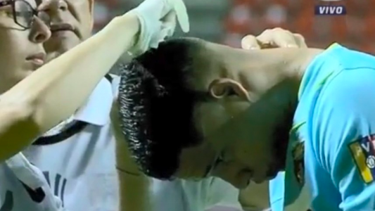 Una locura: Agredieron con una botella de vidrio a su propio arquero