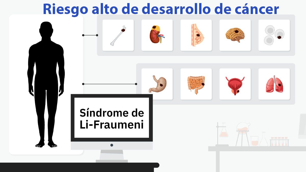 La falla no detectada en material genético de un donante favorece la aparición de varios tipos de cáncer. (Foto: A24.com)