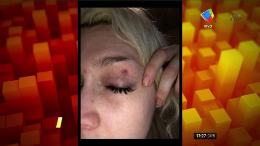 Militta Bora, ¿víctima de un caso de violencia de género?