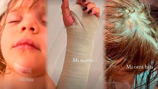 Wanda Nara publicó fotos de las heridas que sufrió su familia