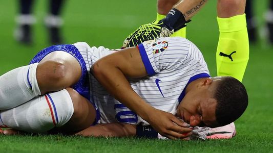 Mbappé sufrió una DURÍSIMA lesión: ¿se pierde el resto la Eurocopa?
