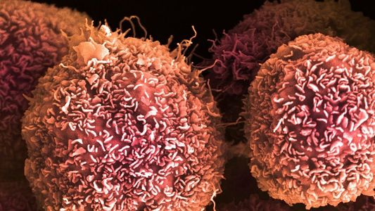 Cáncer de páncreas: un avance clave genera expectativa en la comunidad científica