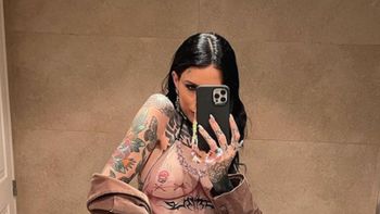 Candelaria Tinelli pasó por el quirófano y contó qué se hizo en la cara