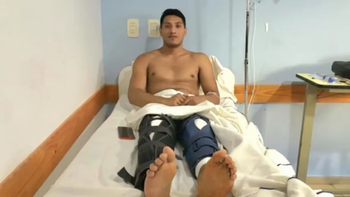 Un joven fue a hacerse una cirugía en la rodilla, despertó y le habían operado las dos piernas. (Foto: gentileza El Día)