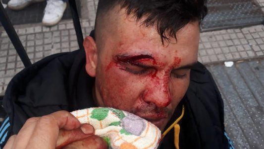 Video: así fue el momento en el cual los manifestantes se enfrentaron con la policía en la 9 de Julio