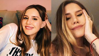 Micaela Tinelli confesó qué cirugía se hizo en la cara hace pocos días