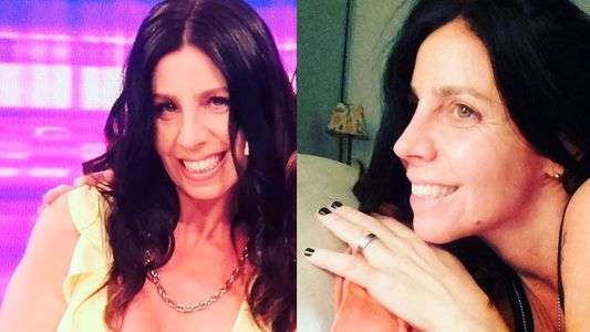 Así le quedó la nariz a Julieta Bal tras su operación: Estoy enamorada de vos