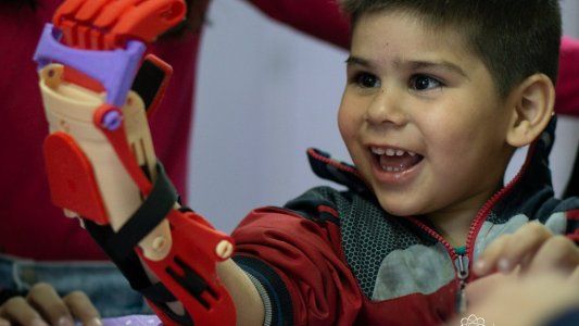 Gino Tubaro advierte sobre las complicaciones que el dólar turista traerá para crear sus prótesis