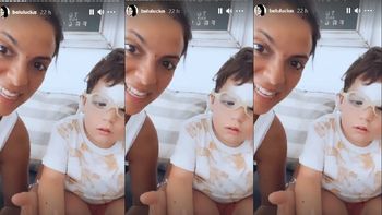 El accidente que sufrió uno de los hijos de Belu Lucius y que terminó con puntos de sutura