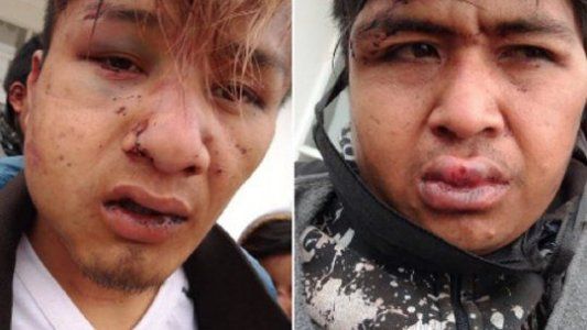 Denuncian a la policía de Chaco por una brutal agresión a una familia Qom