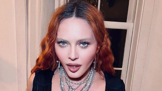 Dieron de alta a Madonna y ya se recupera en su casa de la grave infección bacteriana