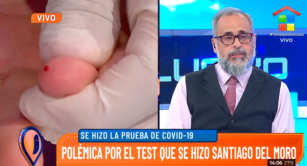 Fuerte crítica de Rial al nuevo ciclo de Santiago del Moro por el test de coronavirus: No están para el show