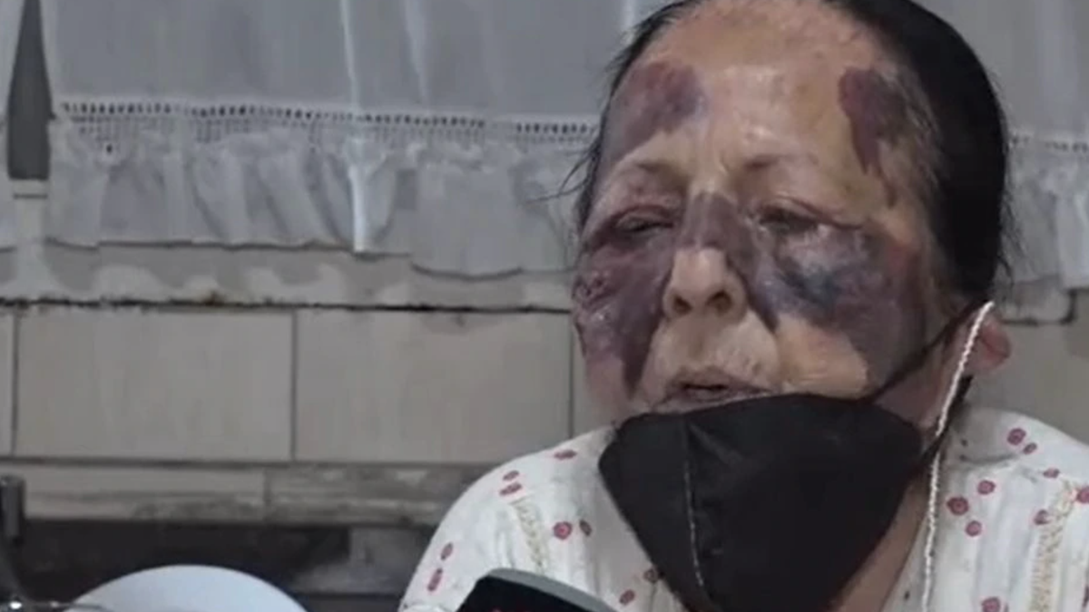 Golopearon a una mujer de 70 años en su propia casa para robarle&nbsp;