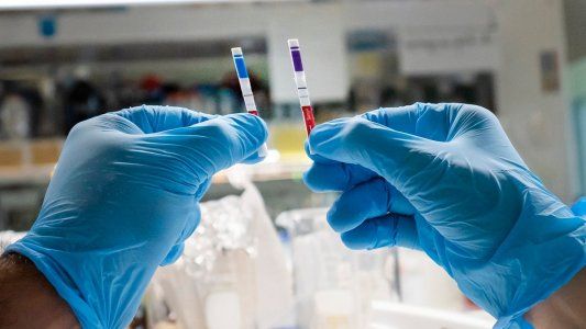 Del laboratorio a la línea de producción: el lado B del nuevo test argentino que detecta al COVID-19