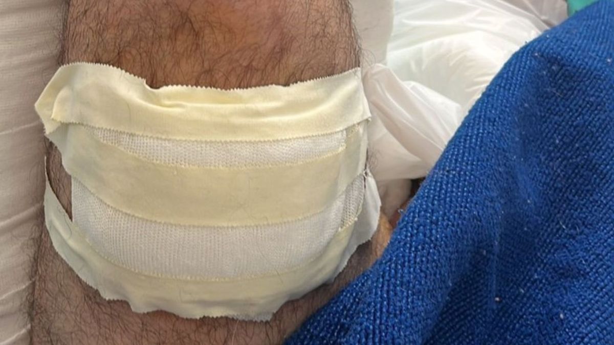 El disparo comprometi&oacute; el f&eacute;mur y deriv&oacute; en una operaci&oacute;n urgente. (Foto: gentileza Clar&iacute;n)
