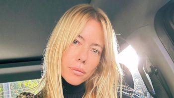 Nicole Neumann reveló su secreto tratamiento estético y mostró los resultados: Piel de bebé