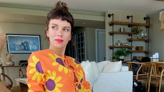 Cuándo se opera Gimena Accardi después del accidente doméstico