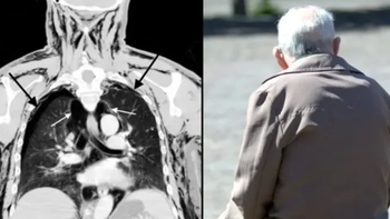 El hombre con el aparato genital más extraño del mundo