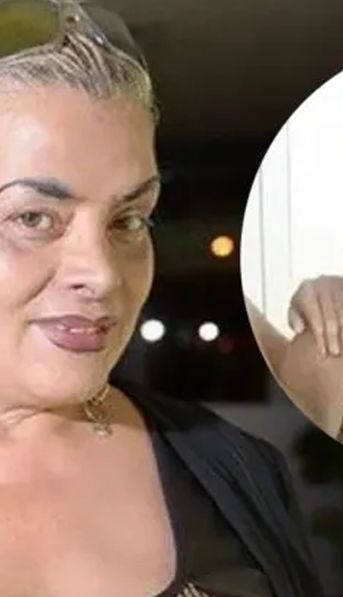 Lía Crucet: Preocupación por la continuidad del tratamiento psicológico