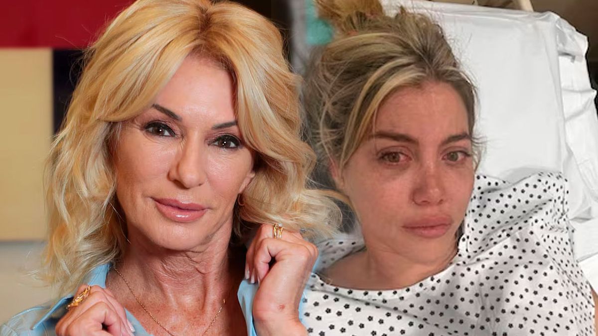 Yanina Latorre advirtió  a Wanda Nara sobre las fuertes consecuencias que podrían dejarle sus nuevas cirugías estéticas