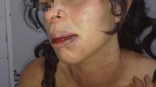 Alarmados por los gritos de socorro, vecinos salvaron a una mujer de la muerte en manos de su ex