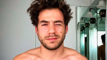 Fer Dente habló tras contar que es hijo de un cura: Con esto convivo hace 12 años