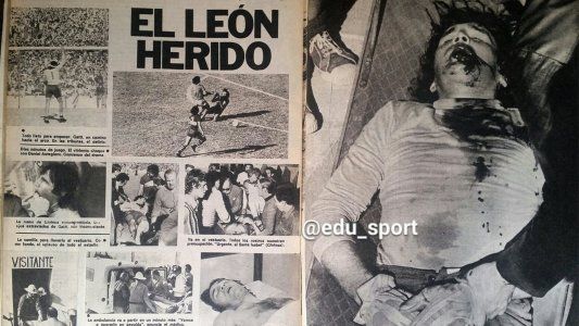 Caso Andrada: el día que Hugo Gatti sufrió una triple fractura de mandíbula y volvió al mes