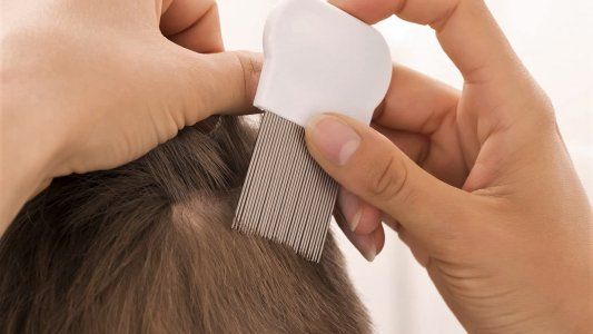 ¿Cómo eliminar los piojos eficazmente?