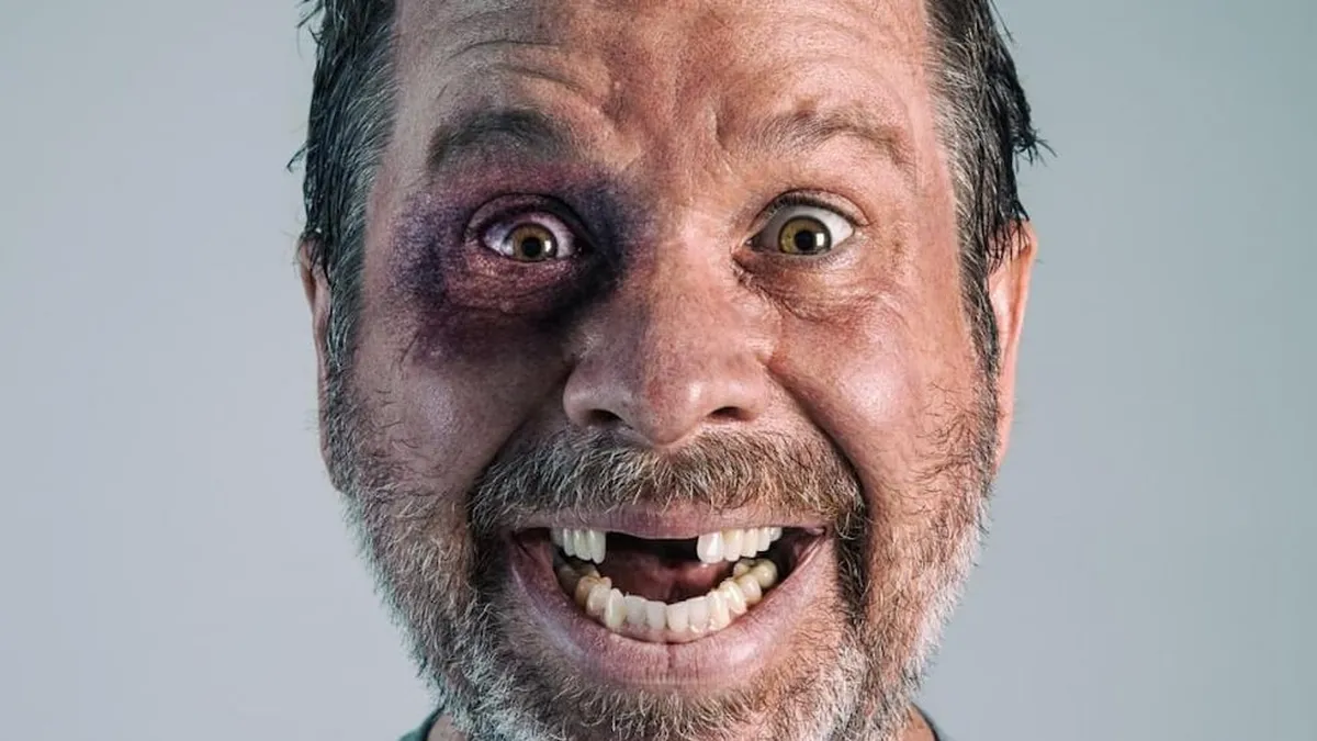 La caída de dientes en los sueños suele reflejar miedo al cambio