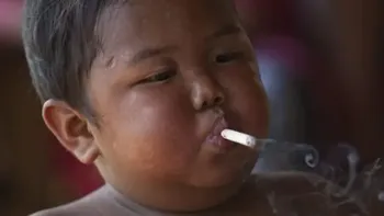 La increíble transformación del nene obeso y fumador de 2 años