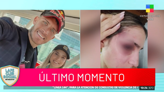 Aparecieron las terribles fotos de Emily Ceco de Love is Blind golpeada tras la detención de Santiago Martínez