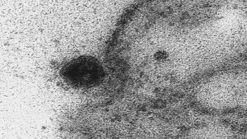 Científicos capturaron el momento exacto en el que el coronavirus infecta una célula