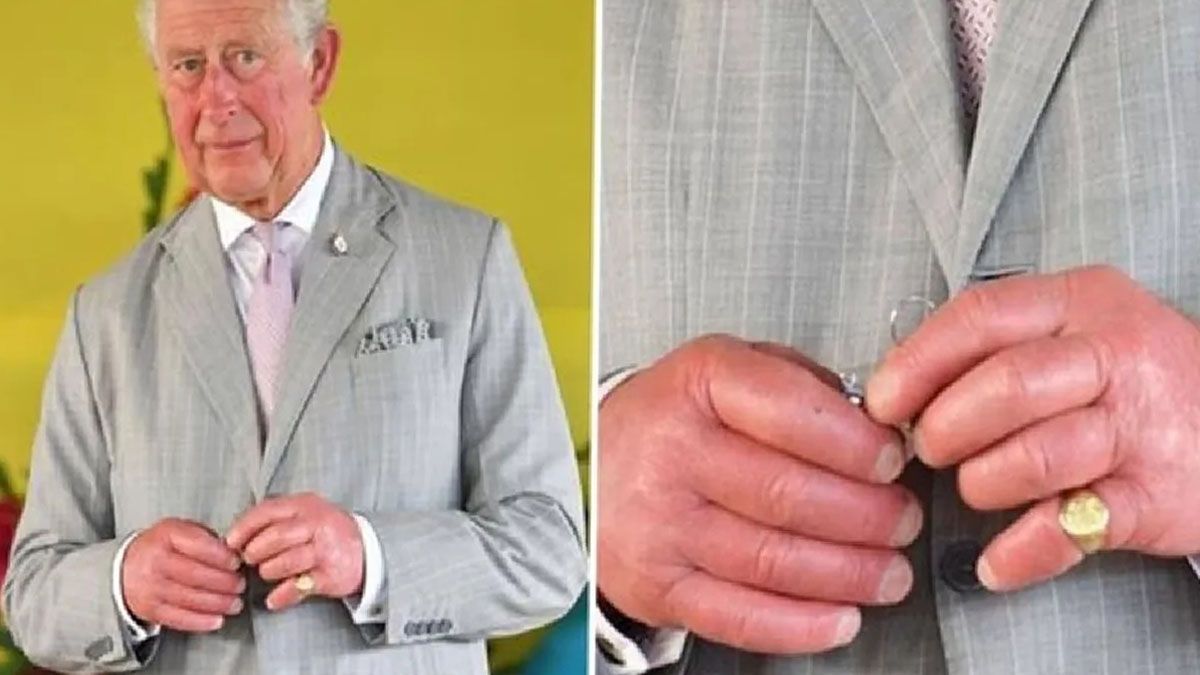 Las manos hinchadas del rey Carlos III y sus dedos en forma de salchicha causan preocupación en el Reino Unido. (Foto: Gentileza NY Post)