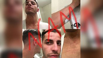 Lhoan habló de las fotos donde aparece rasguñado por Charlotte: Está todo aclarado