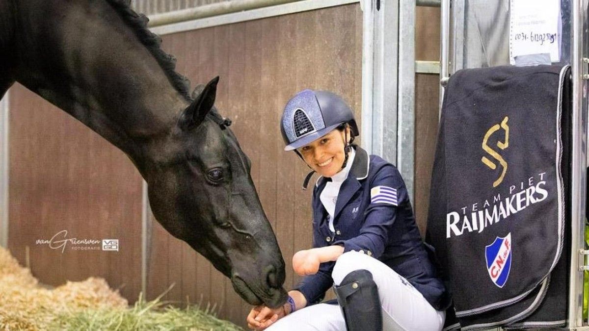 Alfonsina Maldonado tuvo un total de 15 cirugías y la amputación de su mano izquierda. 