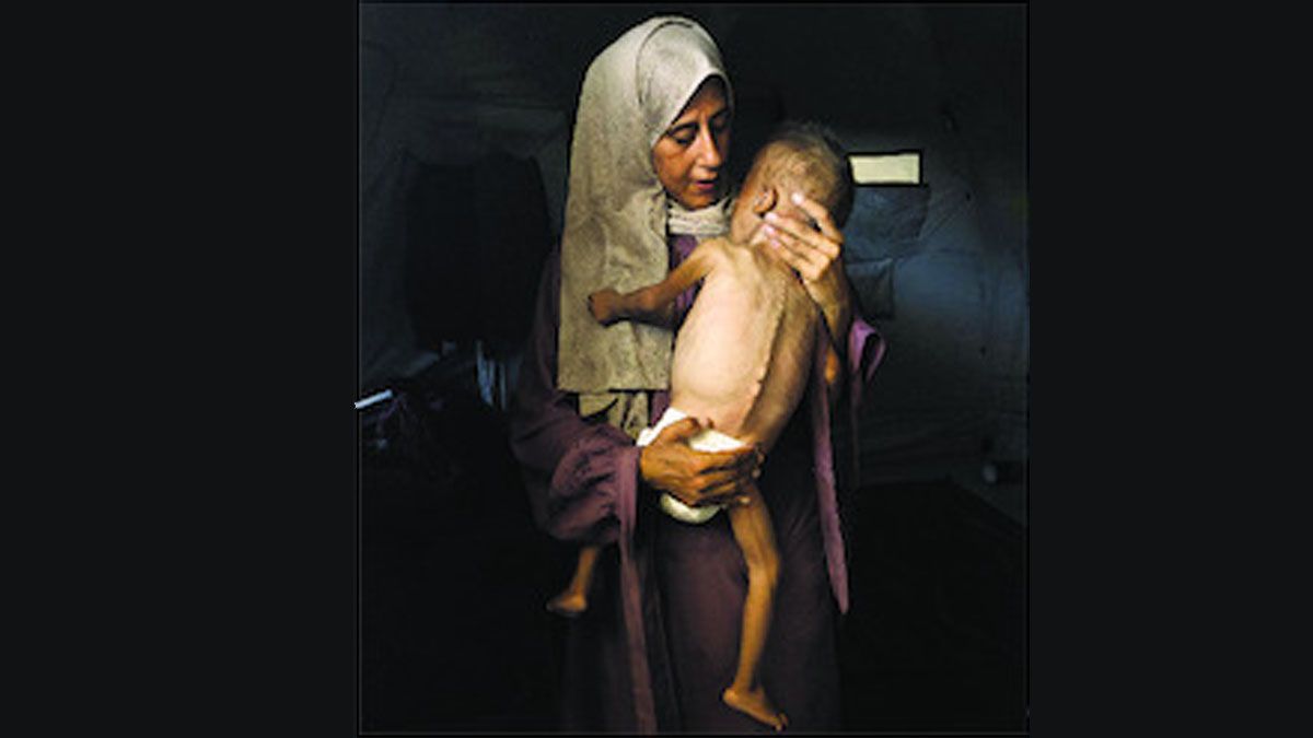 Una madre sostiene a su hijo desnutrido en Gaza. (Foto: Gentileza NYT)