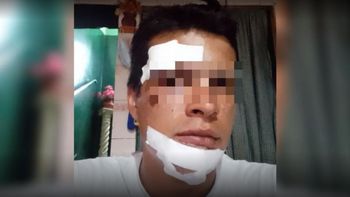 Su novia lo atacó con un ladrillo y dice que no le tomaron la denuncia