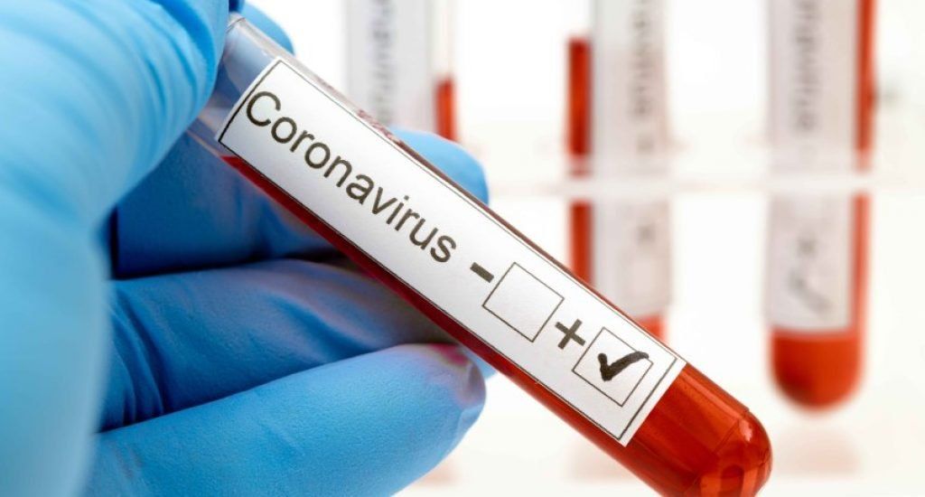 Con 980 nuevos casos, el total de afectados por coronavirus asciende a 21.037, con 632 muertos