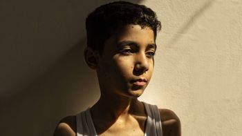 La imagen de un niño mutilado en Gaza ganó como mejor foto del año del World Press Photo