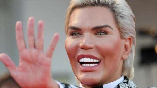 El Ken humano está a punto de quedarse sin nariz y puede terminar con un agujero en la cara