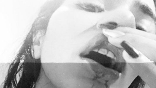 Daniela Cortés, ex pareja de Villa: Las fotos son una recopilación de varias heridas que me causó