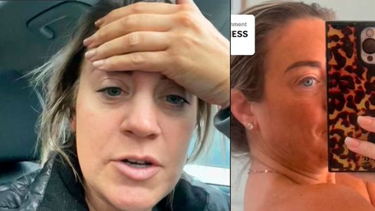 Tomó vino y decidió ponerse autobronceante: el resultado se volvió viral