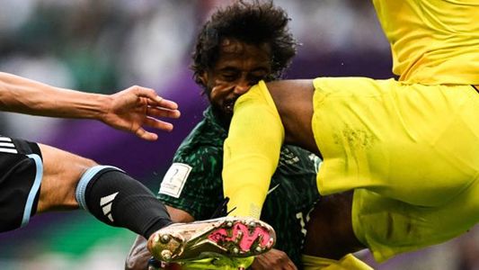 Mundial Qatar 2022: un futbolista de Arabia Suadita chocó con su propio arquero y sufrió una terrible lesión